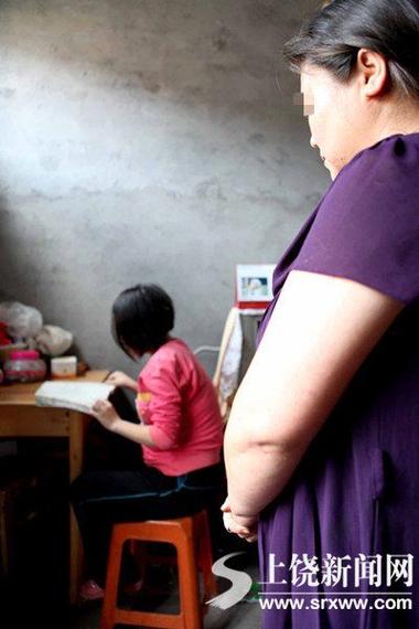 女性每天都有黄色分泌物正常吗的相关介绍