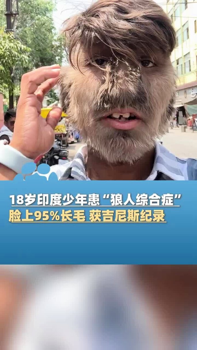 欧美aaaa一区二区麻豆的相关介绍